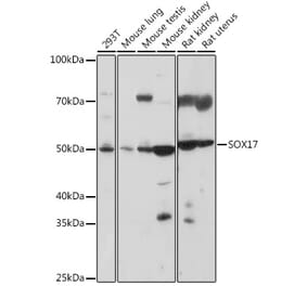 Western Blot - Anti-SOX17 Antibody (A308418) - Antibodies.com