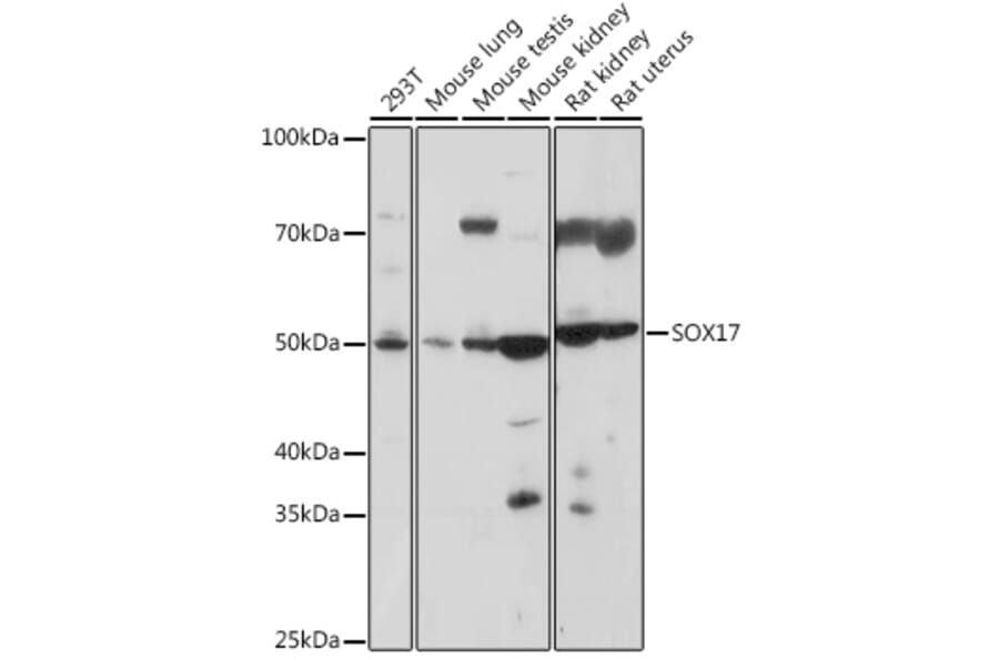 Western Blot - Anti-SOX17 Antibody (A308418) - Antibodies.com