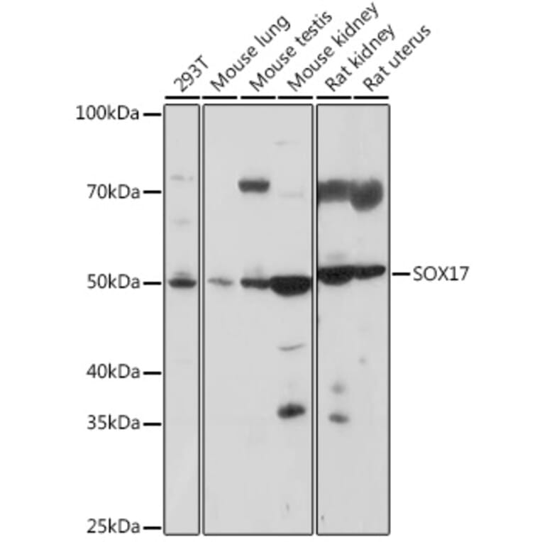 Western Blot - Anti-SOX17 Antibody (A308418) - Antibodies.com