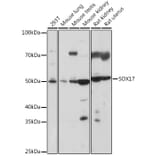 Western Blot - Anti-SOX17 Antibody (A308418) - Antibodies.com