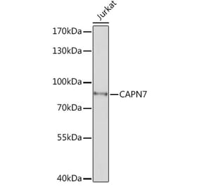 Western Blot - Anti-CAPN7 Antibody (A308419) - Antibodies.com