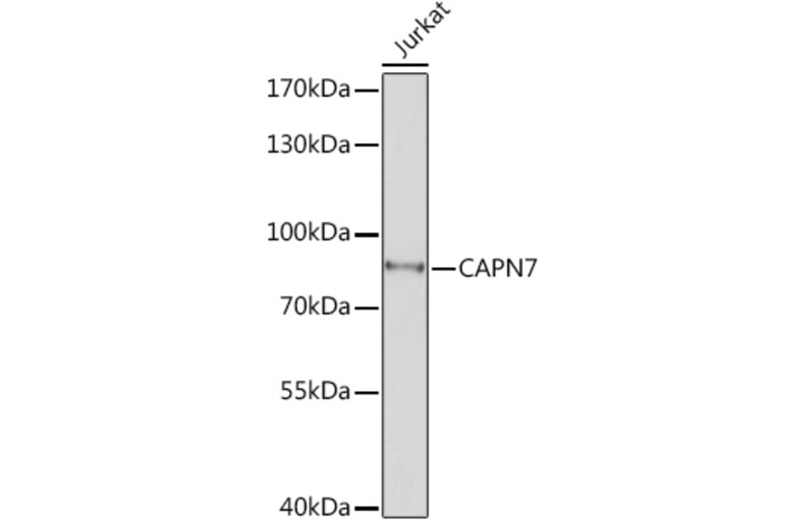 Western Blot - Anti-CAPN7 Antibody (A308419) - Antibodies.com