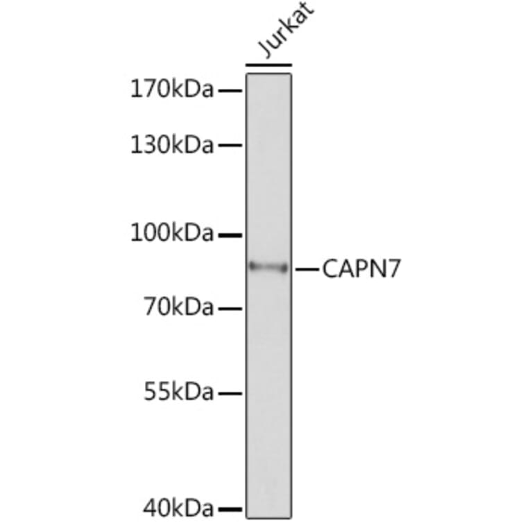 Western Blot - Anti-CAPN7 Antibody (A308419) - Antibodies.com