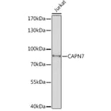 Western Blot - Anti-CAPN7 Antibody (A308419) - Antibodies.com