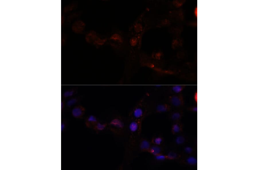 Immunofluorescence - Anti-CAPN7 Antibody (A308419) - Antibodies.com
