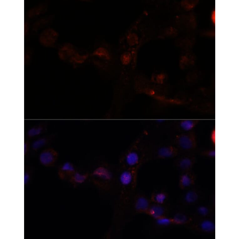 Immunofluorescence - Anti-CAPN7 Antibody (A308419) - Antibodies.com