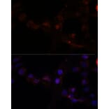 Immunofluorescence - Anti-CAPN7 Antibody (A308419) - Antibodies.com