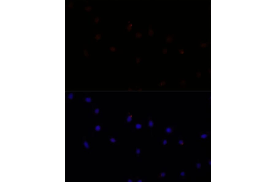 Immunofluorescence - Anti-CAPN7 Antibody (A308419) - Antibodies.com