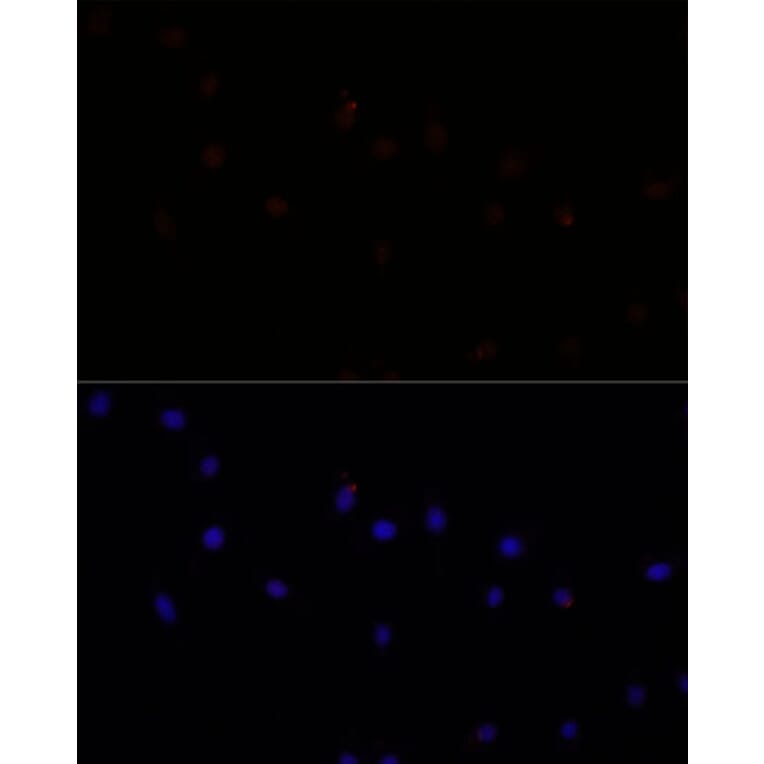 Immunofluorescence - Anti-CAPN7 Antibody (A308419) - Antibodies.com