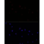 Immunofluorescence - Anti-CAPN7 Antibody (A308419) - Antibodies.com