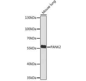 Western Blot - Anti-PANK2 Antibody (A308420) - Antibodies.com