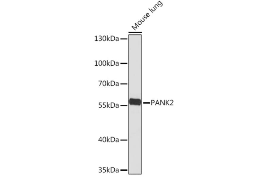 Western Blot - Anti-PANK2 Antibody (A308420) - Antibodies.com