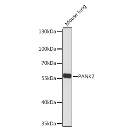Western Blot - Anti-PANK2 Antibody (A308420) - Antibodies.com