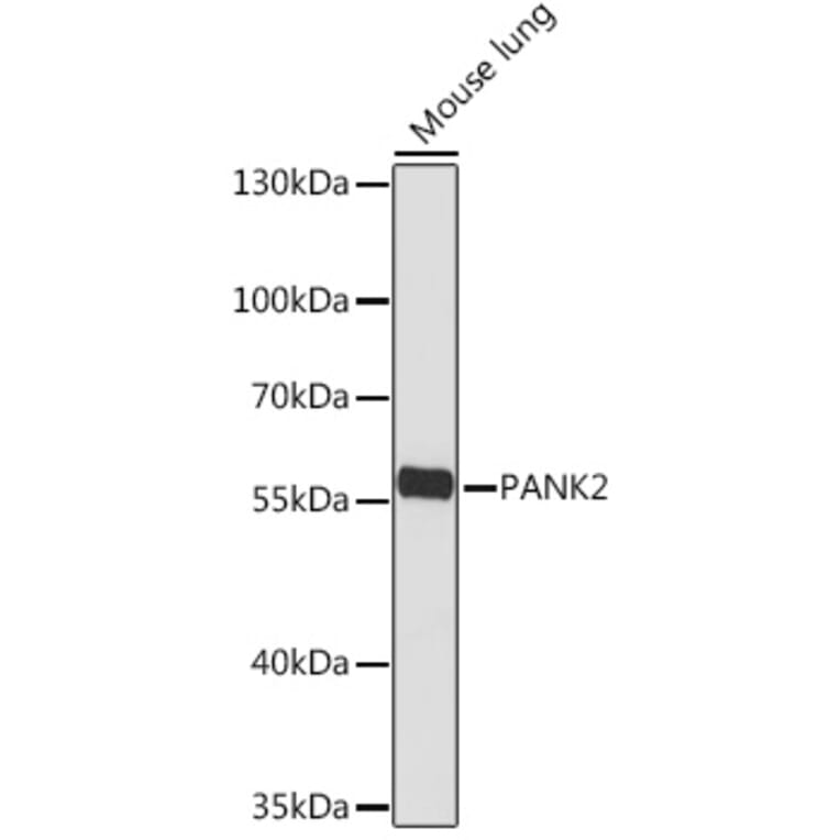 Western Blot - Anti-PANK2 Antibody (A308420) - Antibodies.com