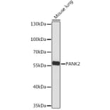 Western Blot - Anti-PANK2 Antibody (A308420) - Antibodies.com