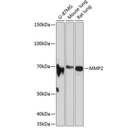 Western Blot - Anti-MMP2 Antibody [ARC0432] (A308421) - Antibodies.com