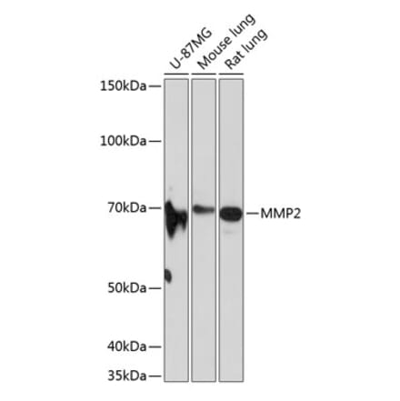 Western Blot - Anti-MMP2 Antibody [ARC0432] (A308421) - Antibodies.com