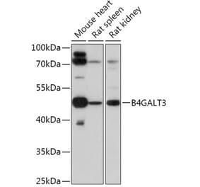 Western Blot - Anti-B4GALT3 Antibody (A308424) - Antibodies.com