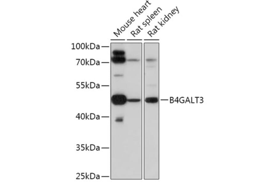 Western Blot - Anti-B4GALT3 Antibody (A308424) - Antibodies.com