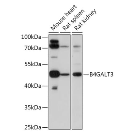 Western Blot - Anti-B4GALT3 Antibody (A308424) - Antibodies.com