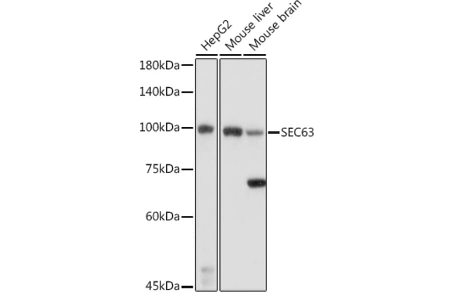 Western Blot - Anti-SEC63 Antibody (A308425) - Antibodies.com