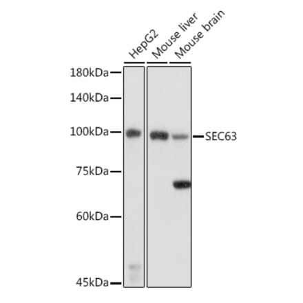 Western Blot - Anti-SEC63 Antibody (A308425) - Antibodies.com