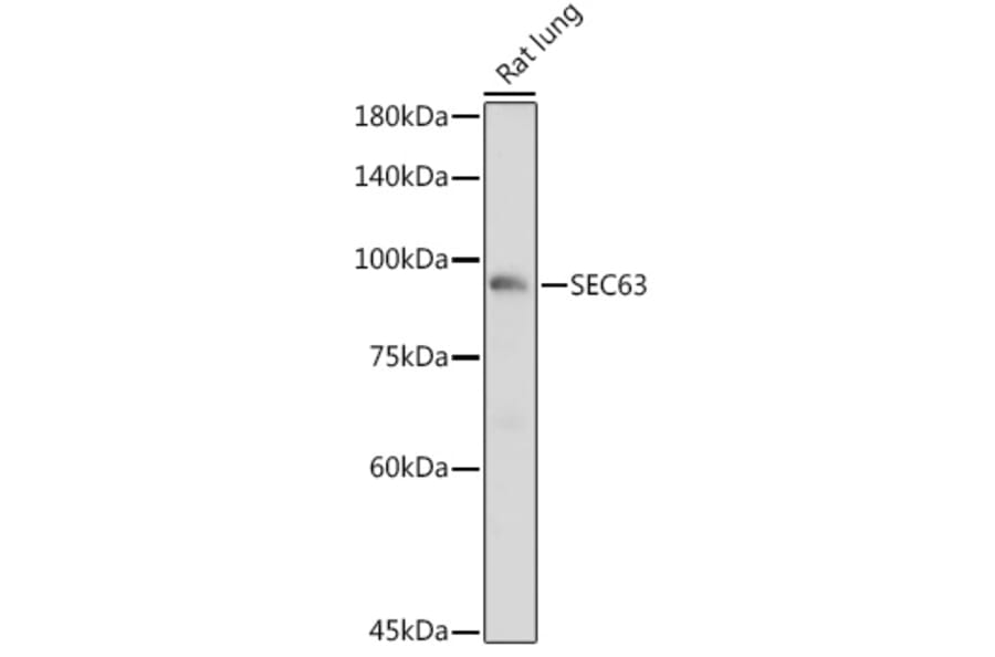 Western Blot - Anti-SEC63 Antibody (A308425) - Antibodies.com