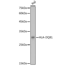 Western Blot - Anti-HLA-DQB1 Antibody (A308426) - Antibodies.com