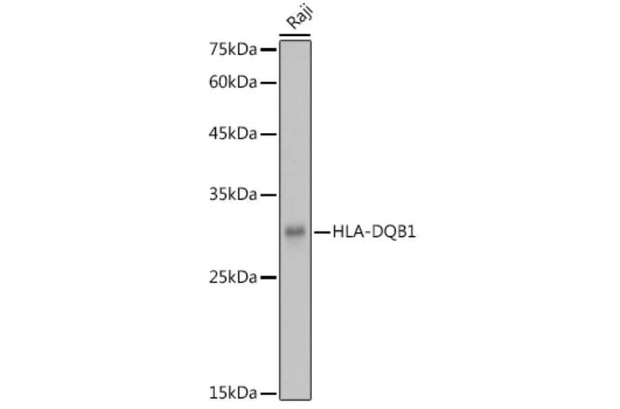 Western Blot - Anti-HLA-DQB1 Antibody (A308426) - Antibodies.com