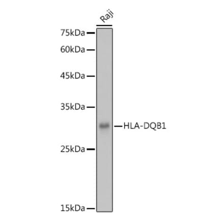 Western Blot - Anti-HLA-DQB1 Antibody (A308426) - Antibodies.com