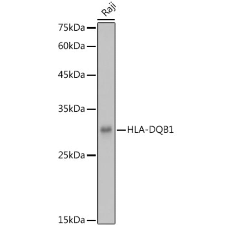 Western Blot - Anti-HLA-DQB1 Antibody (A308426) - Antibodies.com