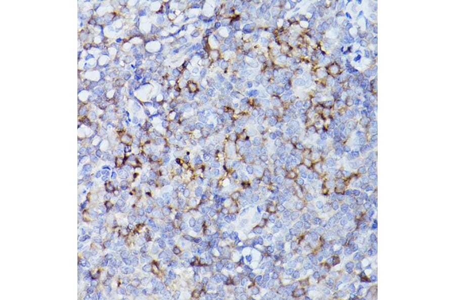 Immunohistochemistry - Anti-HLA-DQB1 Antibody (A308426) - Antibodies.com