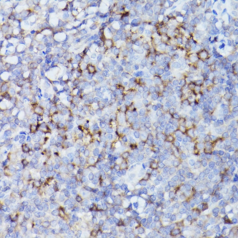 Immunohistochemistry - Anti-HLA-DQB1 Antibody (A308426) - Antibodies.com