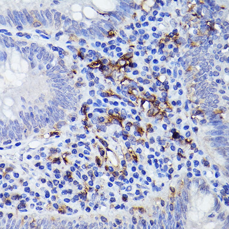 Immunohistochemistry - Anti-HLA-DQB1 Antibody (A308426) - Antibodies.com