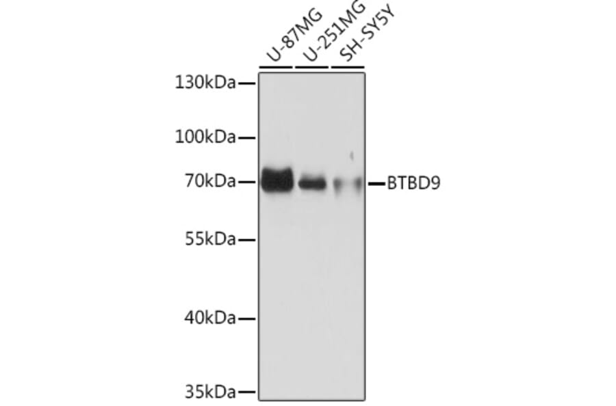 Western Blot - Anti-BTBD9 Antibody (A308427) - Antibodies.com