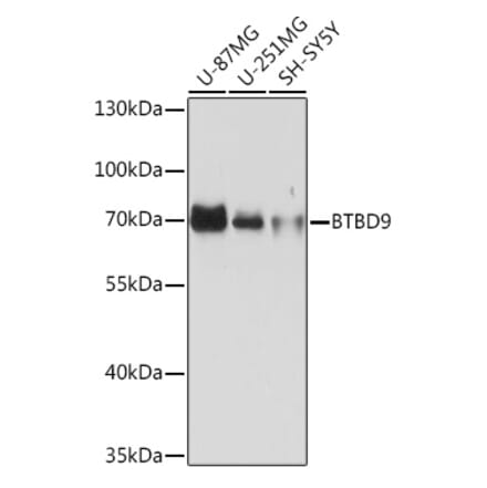 Western Blot - Anti-BTBD9 Antibody (A308427) - Antibodies.com