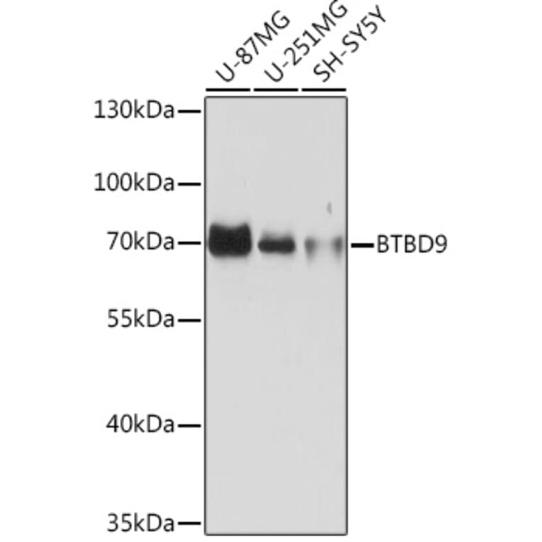 Western Blot - Anti-BTBD9 Antibody (A308427) - Antibodies.com