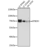 Western Blot - Anti-BTBD9 Antibody (A308427) - Antibodies.com