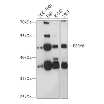 Western Blot - Anti-P2Y8 Antibody (A308428) - Antibodies.com
