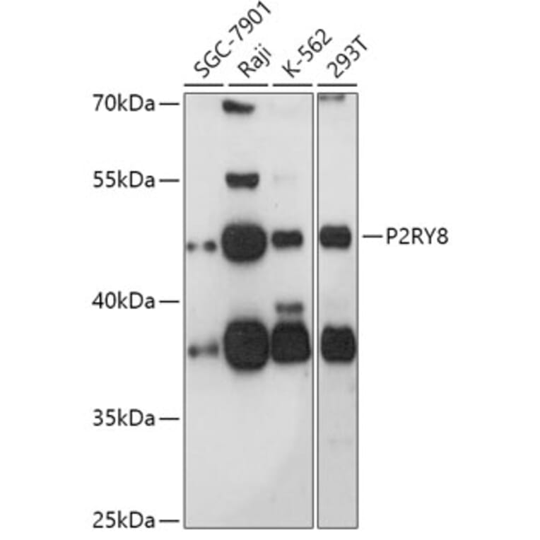 Western Blot - Anti-P2Y8 Antibody (A308428) - Antibodies.com