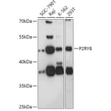 Western Blot - Anti-P2Y8 Antibody (A308428) - Antibodies.com