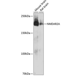 Western Blot - Anti-NMDAR2A Antibody [ARC0410] (A308430) - Antibodies.com