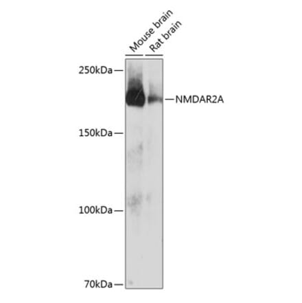 Western Blot - Anti-NMDAR2A Antibody [ARC0410] (A308430) - Antibodies.com
