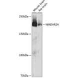 Western Blot - Anti-NMDAR2A Antibody [ARC0410] (A308430) - Antibodies.com