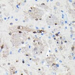 Immunohistochemistry - Anti-NMDAR2A Antibody [ARC0410] (A308430) - Antibodies.com