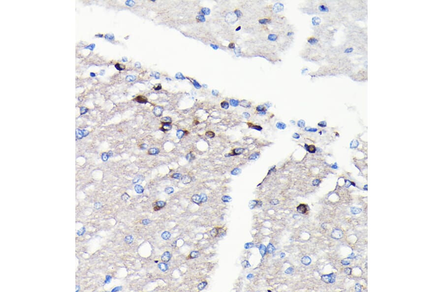 Immunohistochemistry - Anti-NMDAR2A Antibody [ARC0410] (A308430) - Antibodies.com