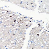 Immunohistochemistry - Anti-NMDAR2A Antibody [ARC0410] (A308430) - Antibodies.com