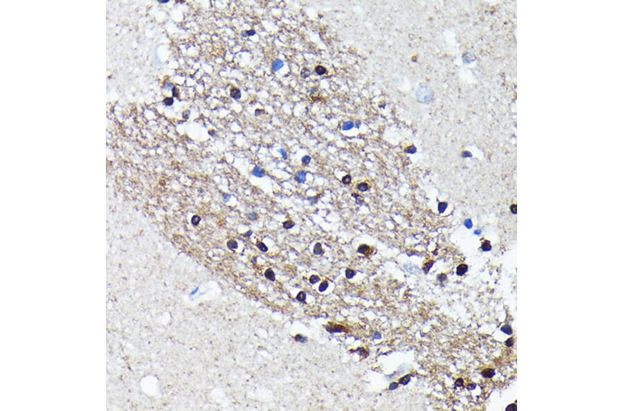 Immunohistochemistry - Anti-NMDAR2A Antibody [ARC0410] (A308430) - Antibodies.com
