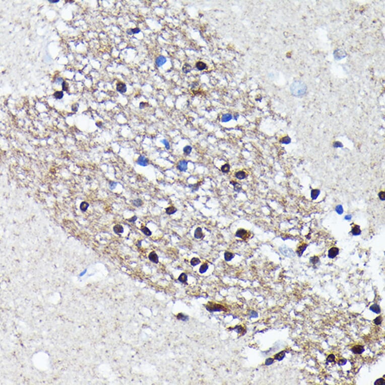 Immunohistochemistry - Anti-NMDAR2A Antibody [ARC0410] (A308430) - Antibodies.com