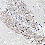 Immunohistochemistry - Anti-NMDAR2A Antibody [ARC0410] (A308430) - Antibodies.com